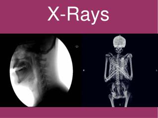 X-Rays