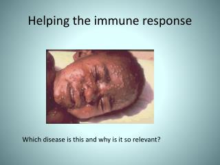 Helping the immune response