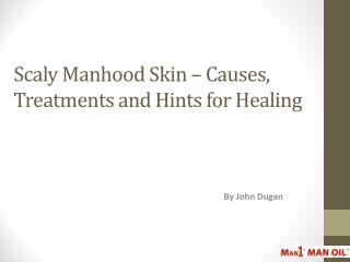 Scaly Manhood Skin – Causes, Treatments and Hints