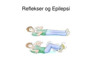 Reflekser og Epilepsi