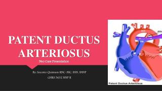 PATENT DUCTUS ARTERIOSUS Neo Case Presentation