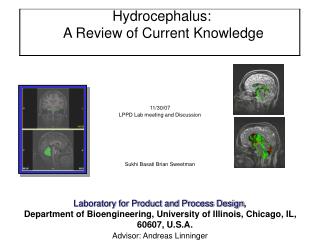 Hydrocephalus: A Review of Current Knowledge