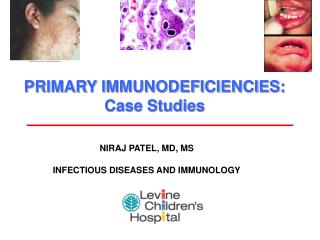 PRIMARY IMMUNODEFICIENCIES: Case Studies