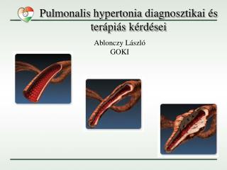 Pulmonalis hypertonia diagnosztikai és terápiás kérdései