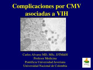 Complicaciones por CMV asociadas a VIH