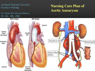 An-Najah National University Faculty of Nursing Dr Aidah Abu Alsoud Alkaissi RN, BSc, MSc, PhD