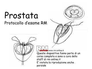 Prostata Protocollo d’esame RM