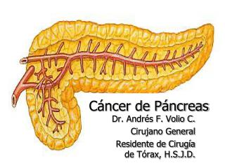 Cáncer de Páncreas