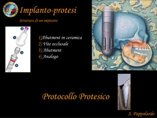 Implanto-protesi