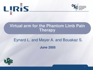 Virtual arm for the Phantom Limb Pain Therapy