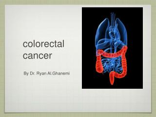 colorectal cancer