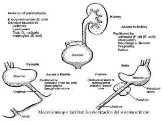 Mecanismos que facilitan la colonización del sistema urinario