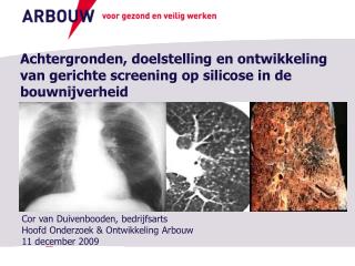 Cor van Duivenbooden , bedrijfsarts Hoofd Onderzoek &amp; Ontwikkeling Arbouw 11 december 2009