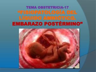 TEMA OBSTETRICIA-17 “FISIOPATOLOGÍA DEL LÍQUIDO AMNIÓTICO. EMBARAZO POSTÉRMINO”