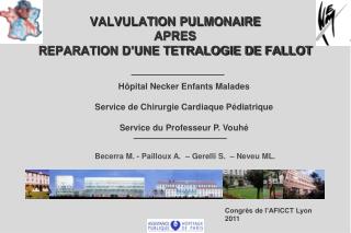 VALVULATION PULMONAIRE APRES REPARATION D’UNE TETRALOGIE DE FALLOT