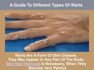 A Guide To Different Types Of Warts