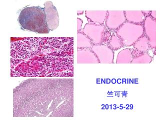 ENDOCRINE 竺可青 2013-5-29