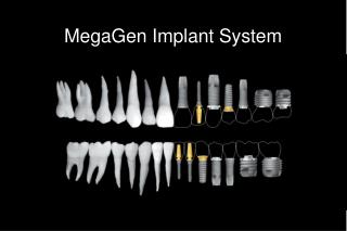 MegaGen Implant System