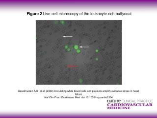 Figure 2 Live-cell microscopy of the leukocyte-rich buffycoat