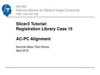 Slicer3 Tutorial: Registration Library Case 15 AC-PC Alignment