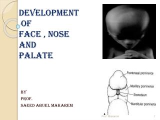 DEVELOPMENT OF FACE , NOSE AND PALATE