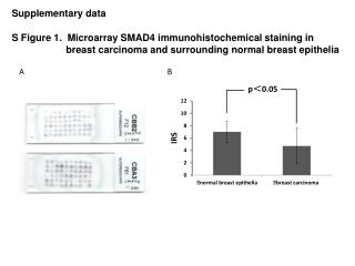 S Figure 1. Microarray SMAD4 immunohistochemical staining in