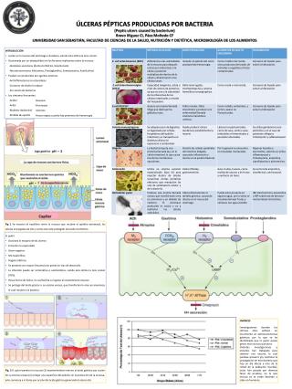 ÚLCERAS PÉPTICAS PRODUCIDAS POR BACTERIA (Peptic ulcers caused by bacterium)