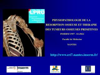 PHYSIOPATHOLOGIE DE LA RESORPTION OSSEUSE ET THERAPIE DES TUMEURS OSSEUSES PRIMITIVES