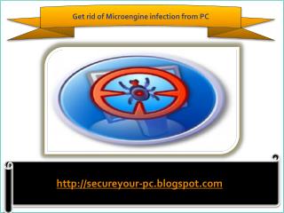 How To Remove Microengine
