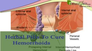 Herbal Pills To Cure Hemorrhoids Problem