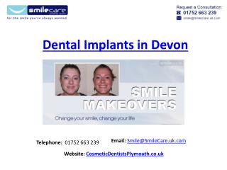 Dental Implants Devon