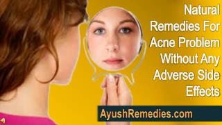 Natural Remedies For Acne Problem Without Any Adverse Side E