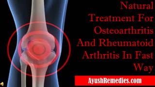 Natural Treatment For Osteoarthritis And Rheumatoid Arthriti