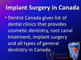 Implant Surgery in Canada