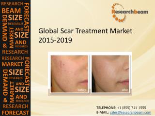Global Scar Treatment Market Size, Trends, Technology