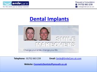 Dental implants