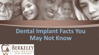 Dental Implant Facts you may not know.