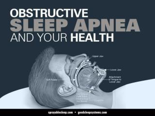 Obstructive Sleep Apnea and your Health
