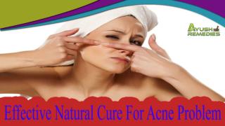 Effective Natural Cure For Acne Problem