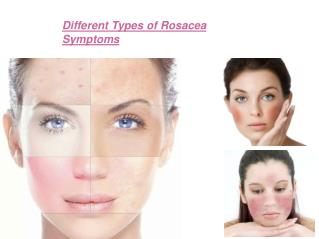 Different Types of Rosacea Symptoms