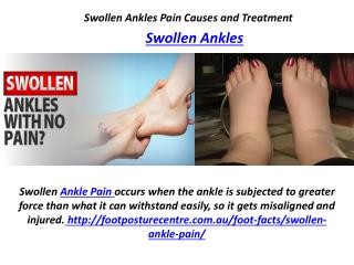 Swollen Ankles Pain Causes and Treatment