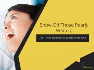 Show Off Those Pearly Whites: The Three Benefits of Teeth Whitening