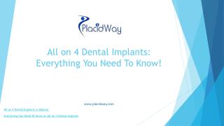 All on 4 Dental Implants: Everything You Need To Know!