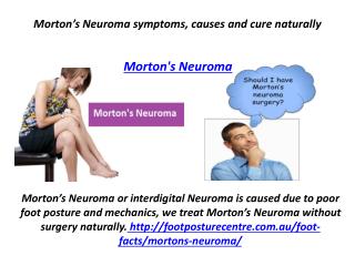 Morton’s Neuroma symptoms, causes and cure naturally