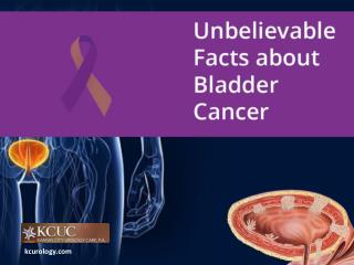 Unbelievable Facts about Cancer in the Bladder