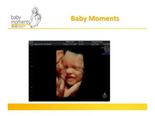 Amazing 4D Baby scan in Berkshire call 08000075076