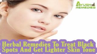 Herbal Remedies To Treat Black Spots And Get Lighter Skin Tone