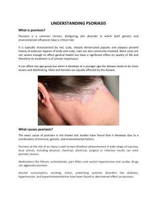 Understanding Psoriasis