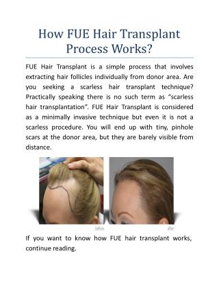 How Fue Hair Transplant Process Works?