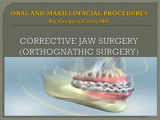Corrective Jaw Surgery by Dr. Gregory Casey